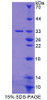 Human Recombinant Protein Kinase D3 (PKD3)