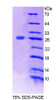 Mouse Recombinant Protein O-Mannosyltransferase 1 (POMT1)