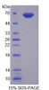 Human Recombinant Poly U Binding Splicing Factor 60kDa (PUF60)