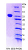 Human Recombinant Thymocyte Nuclear Protein 1 (THYN1)