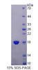 Human Recombinant Trafficking Protein Particle Complex 2 (TRAPPC2)