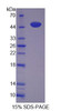 Human Recombinant Renalase (RNLS)