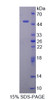 Human Recombinant Smoothelin (SMTN)