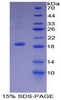 Human Recombinant Dermcidin (DCD)