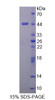 Human Recombinant Deoxyhypusine Synthase (DHPS)