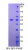 Human Recombinant Fibroblast Growth Factor 18 (FGF18)