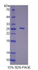 Human Recombinant Fibroblast Growth Factor 20 (FGF20)