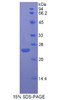 Rat Recombinant Fibroblast Growth Factor 13 (FGF13)