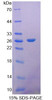 Human Recombinant Fibroblast Growth Factor 21 (FGF21)