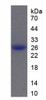 Mouse Recombinant Cathepsin B (CTSB)