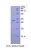 Human Recombinant Cathepsin C (CTSC)