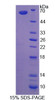 Mouse Recombinant Asparaginyl tRNA Synthetase (NARS)