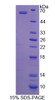 Human Recombinant Isoleucyl tRNA Synthetase (IARS)