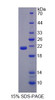 Mouse Recombinant Glutamyl Prolyl tRNA Synthetase (EPRS)