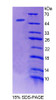 Mouse Recombinant Acid Phosphatase 6, Lysophosphatidic (ACP6)