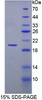 Horse Recombinant Hemoglobin Beta (HBb)