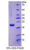 Human Recombinant Fibulin 5 (FBLN5)