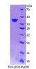 Human Recombinant Ribonuclease H2 Subunit A (RNASEH2A)