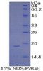 Human Recombinant Sucrase Isomaltase (SI)