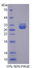Human Recombinant Transportin 2 (TNPO2)