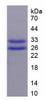 Pig Recombinant Troponin T Type 2, Cardiac (TNNT2)