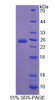 Human Recombinant Ataxin 10 (ATXN10)