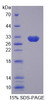 Human Recombinant Aldolase C, Fructose Bisphosphate (ALDOC)