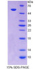 Human Recombinant Amiloride Sensitive Sodium Channel Subunit Alpha (SCNN1a)