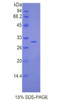 Mouse Recombinant Interleukin 17 Receptor C (IL17RC)