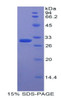 Human Recombinant Myosin IE (MYO1E)