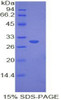 Mouse Recombinant Myosin IE (MYO1E)