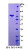 Mouse Recombinant Myosin IG (MYO1G)