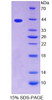 Human Recombinant Tropomyosin 2 Beta (TPM2)