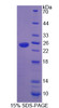 Human Recombinant Heat Shock Protein Beta 7 (HSPb7)