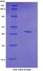 Mouse Recombinant Topoisomerase II Beta (TOP2b)