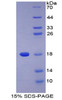 Human Recombinant Phospholipase A2, Group IIA (PLA2G2A)
