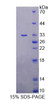 Human Recombinant Alanine Glyoxylate Aminotransferase 2 (AGXT2)