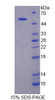 Human Recombinant Dipeptidyl Peptidase 7 (DPP7)