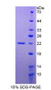 Human Recombinant Tumor Necrosis Factor Receptor Superfamily, Member 14 (TNFRSF14)