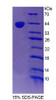 Human Recombinant Testicular Receptor 2 (TR2)