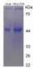 OVA Conjugated Homocysteine (HCy)