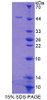 Human Recombinant Protein Phosphatase 3, Regulatory Subunit 1 (PPP3R1)