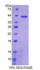 Rat Recombinant Protein Phosphatase 2A Activator, Regulatory Subunit 4 (PPP2R4)