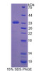 Mouse Recombinant Protocadherin 15 (PCDH15)