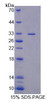 Human Recombinant Ephrin Type A Receptor 10 (EPHA10)