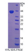 Human Recombinant Proprotein Convertase Subtilisin/Kexin Type 5 (PCSK5)