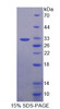 Human Recombinant Proprotein Convertase Subtilisin/Kexin Type 9 (PCSK9)