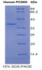 Human Recombinant Proprotein Convertase Subtilisin/Kexin Type 9 (PCSK9)