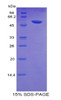 Human Recombinant Glucose Transporter 14 (GLUT14)
