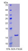 Human Recombinant Glucose Transporter 14 (GLUT14)